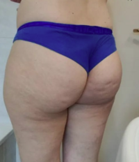 ASSbrazilianBLUEcelluliteCOSCEmorettamarisa5106.png